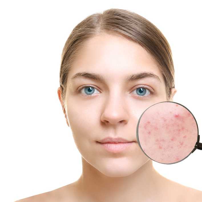 Витамин с: польза для кожи | блог anti-age expert