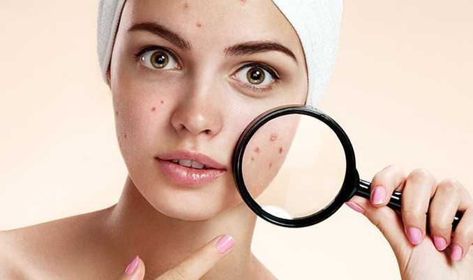 Как бороться с «маскне». проблемы с кожей, вызванные пандемией коронавирусной инфекции - клиника косметологии