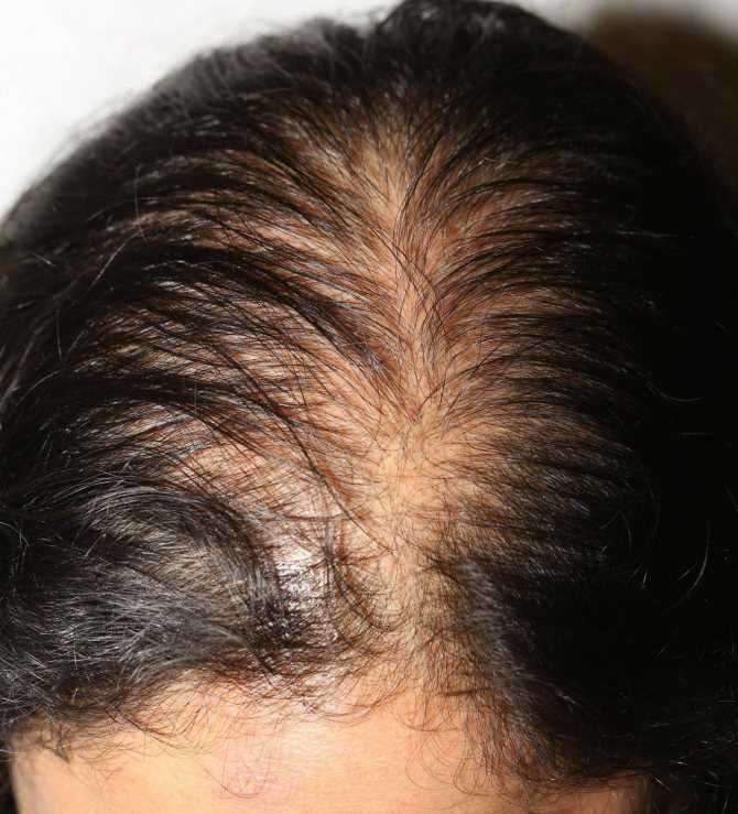 Детский шампунь для взрослых волос: можно ли мыть голову детским шампунем - thevolosy