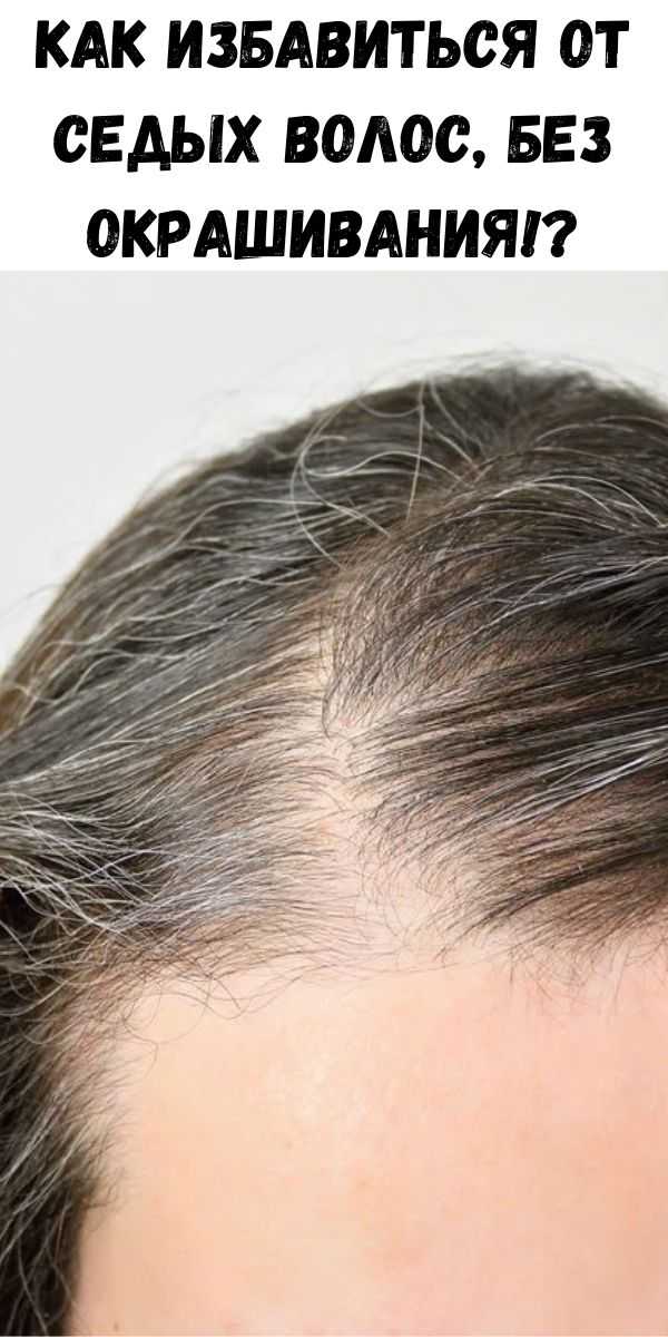 Ранняя седина: причины и лечение (у женщин и мужчин) - клиника «доктор волос»