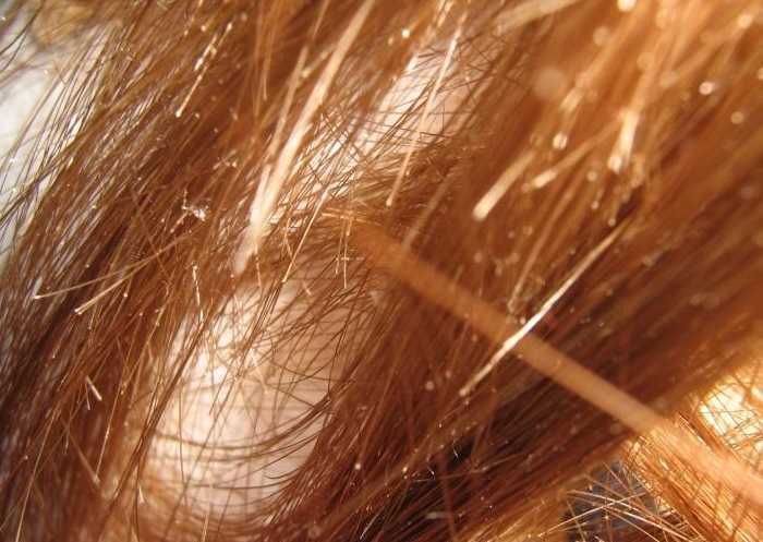 Восстановление сухих и безжизненных волос - методы и средства восстановления