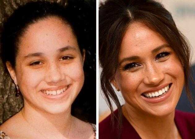 Улыбка на миллион: зубы звезд до и после вмешательства стоматолога