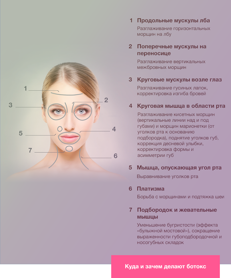 Ботокс в жевательные мышцы схема