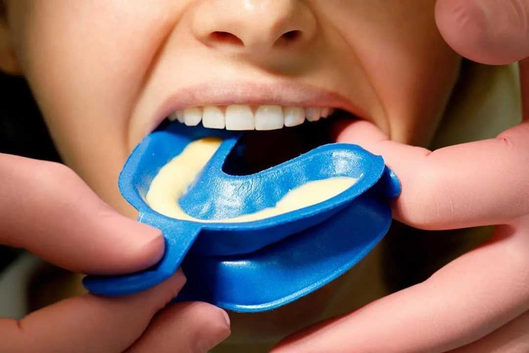 Как восстановить эмаль на зубах в домашних условиях: можно ли заняться восстановлением зубных пластин самостоятельно