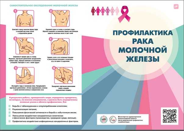Стадии рака молочной железы: прогноз, лечение, симптомы в международной клинике медика24