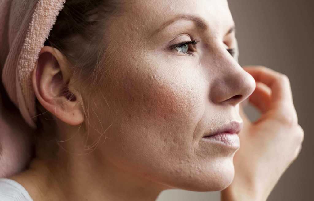 Самые распространенные проблемы кожи: как с ними бороться? - косметология доктора корчагиной