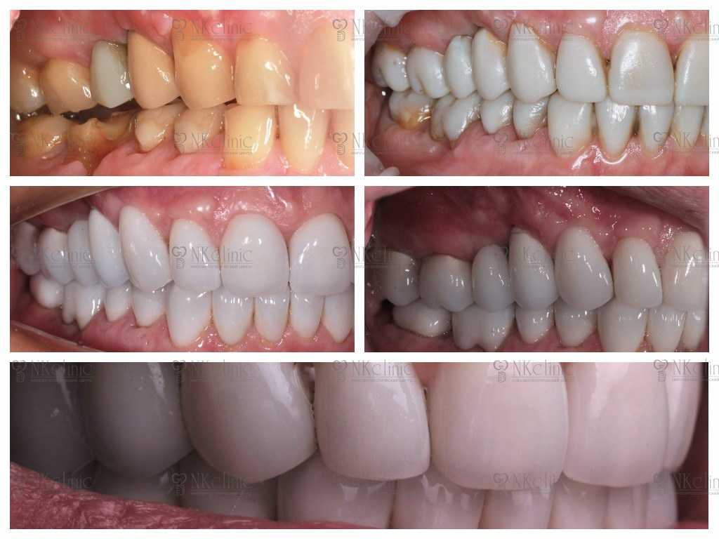 10 вопросов к стоматологу