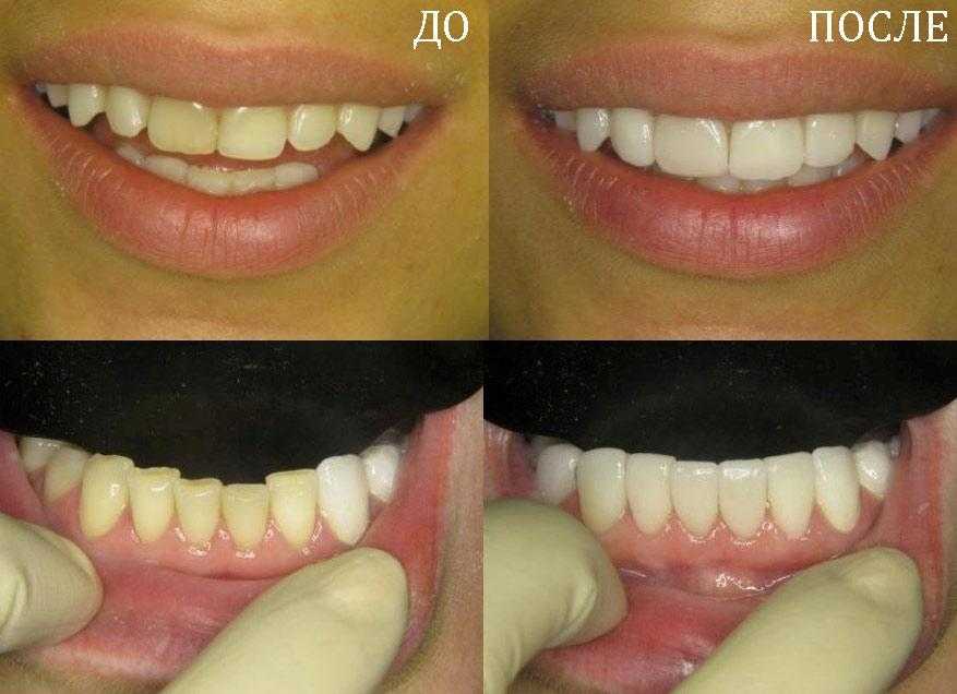 10 вопросов, которые вы всегда хотели задать стоматологу. ответы вас удивят