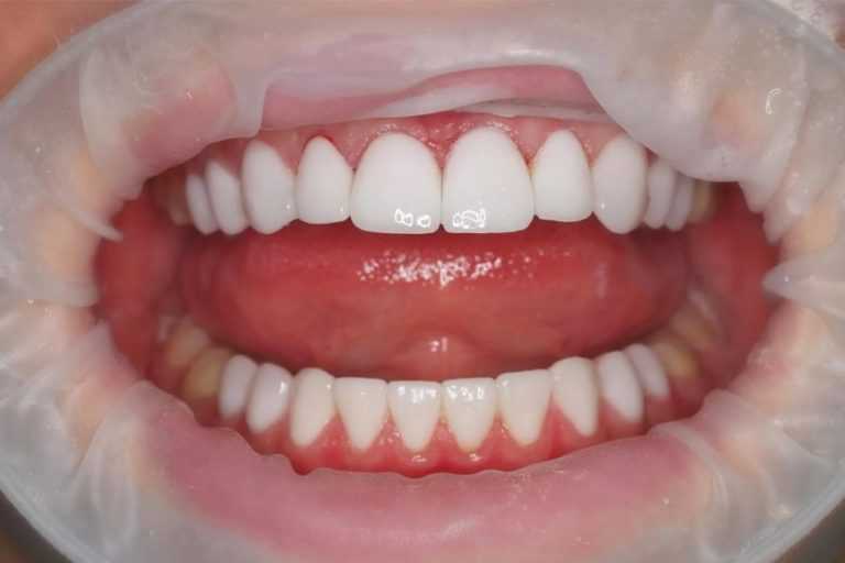 Можно ли заразиться коронавирусом в стоматологии?