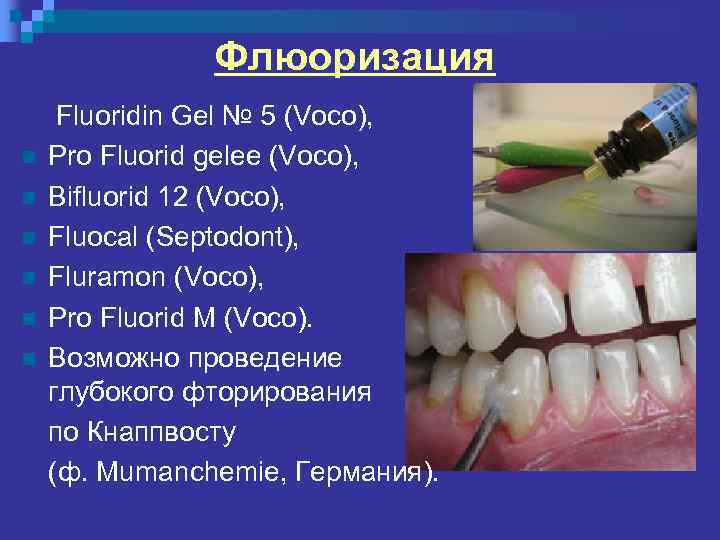 Лаки для зубов: виды, показания, способы применения, альтернативы