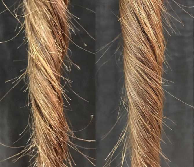 Выпадение волос у девушек: причины, лечение и профилактика
