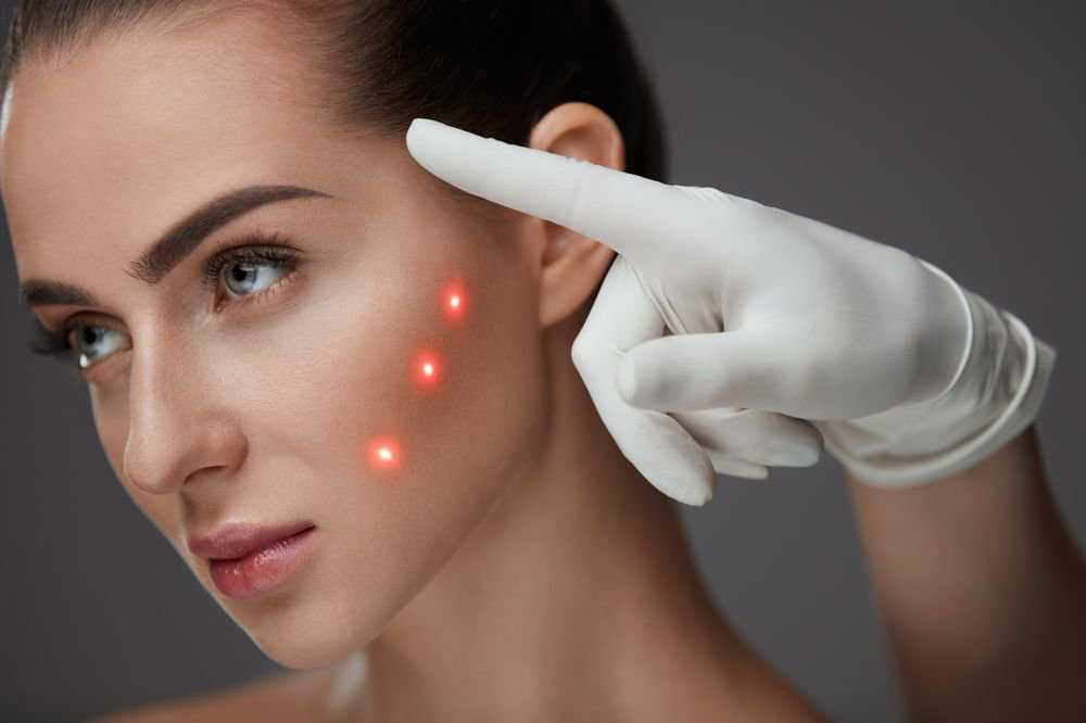 Что нужно узнать о лазерном лечении рубцов, перед тем, как записаться на процедуры - клиника косметологии