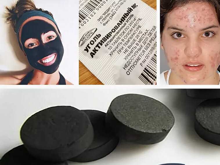 Маски для лица от черных точек: очищающие маски, которые действительно помогают