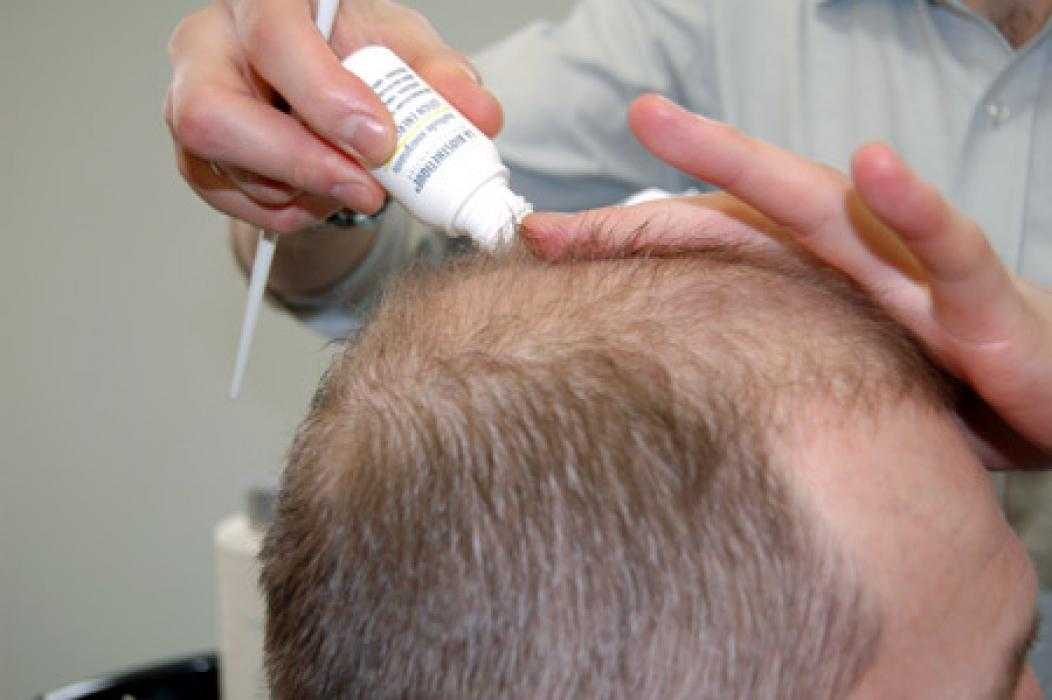 Средства для густоты волос решают проблему 2 основными способами либо активизируют волосяные фолликулы, либо увеличивают толщину волоска
