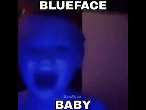 Методика baby face - запуск кнопки омоложения. акупунктурный лифтинг лица.