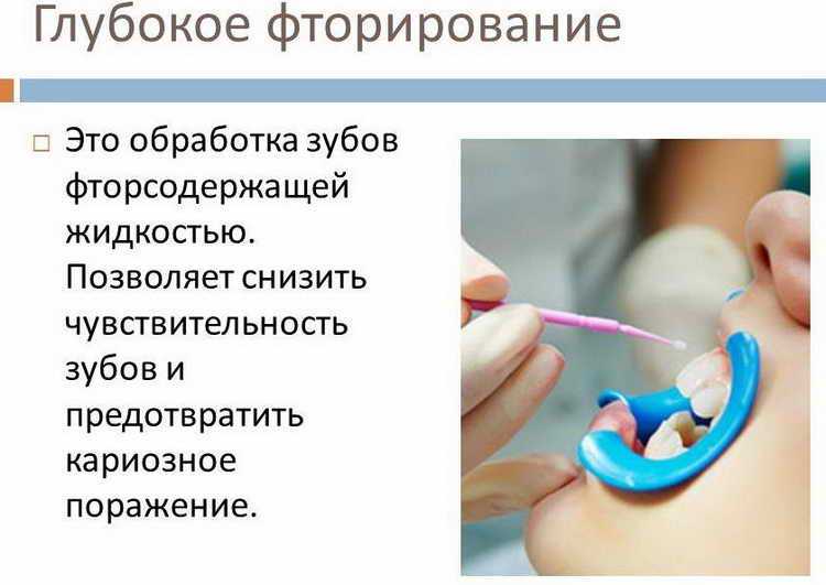Лучшая зубная паста с фтором - для чего нужен фтор в зубной пасте