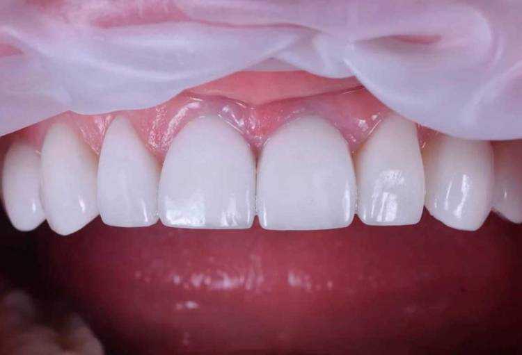 30 вопросов стоматологам, которые вы мечтали задать